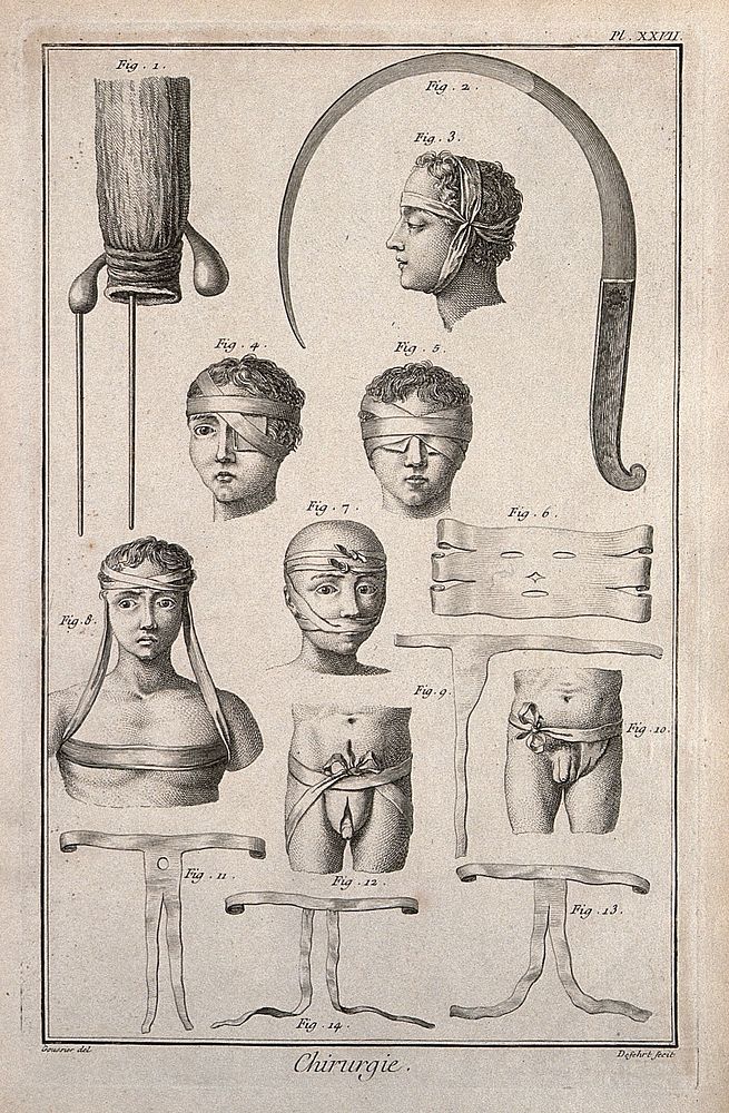 Surgery: top, a rectum with a fistula; below, a number of bandages. Engraving with etching by A.J. Defehrt after L.-J.…