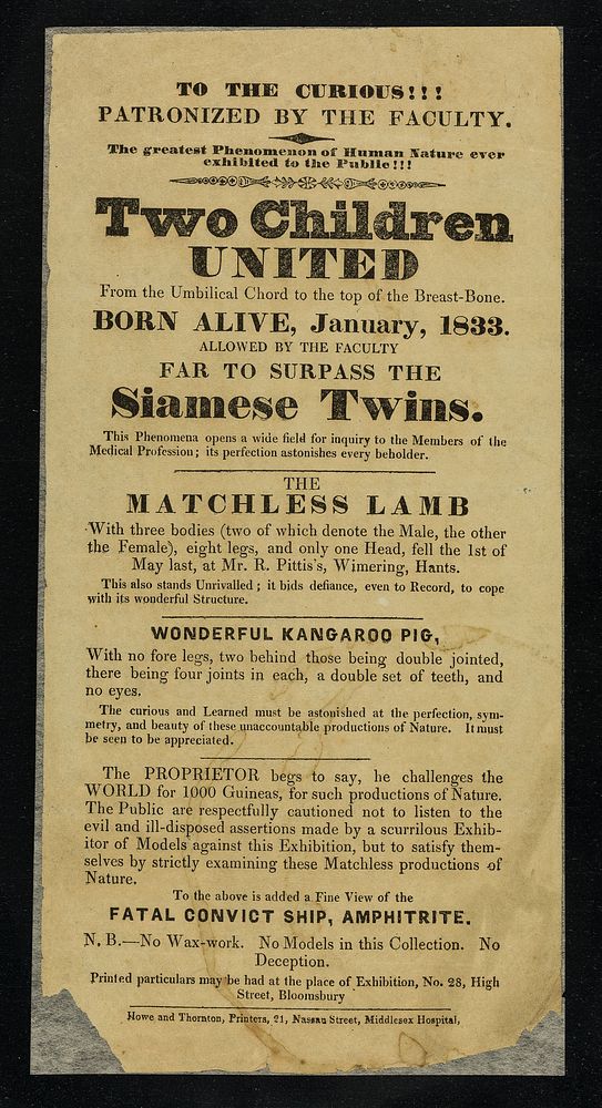 [Leaflet advertising appearances by "Two children united from the umbilical chord to the top of the breast bone", born…