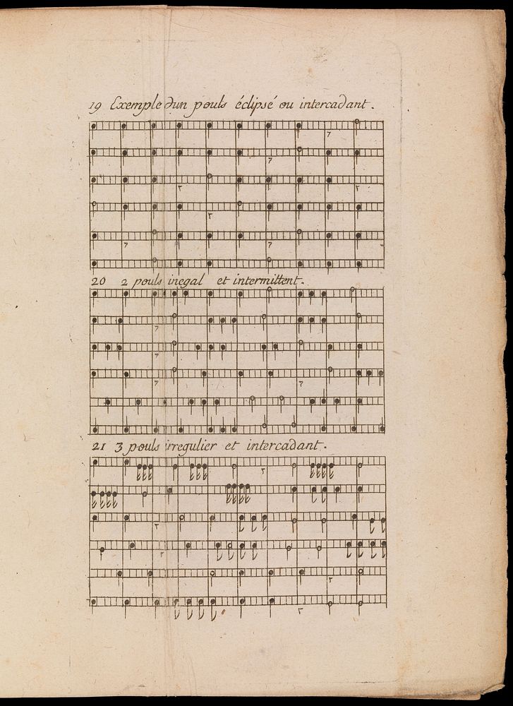 Nouvelle méthode facile et curieuse, pour connoitre le pouls par les notes de la musique ... / [François Nicolas Marquet].