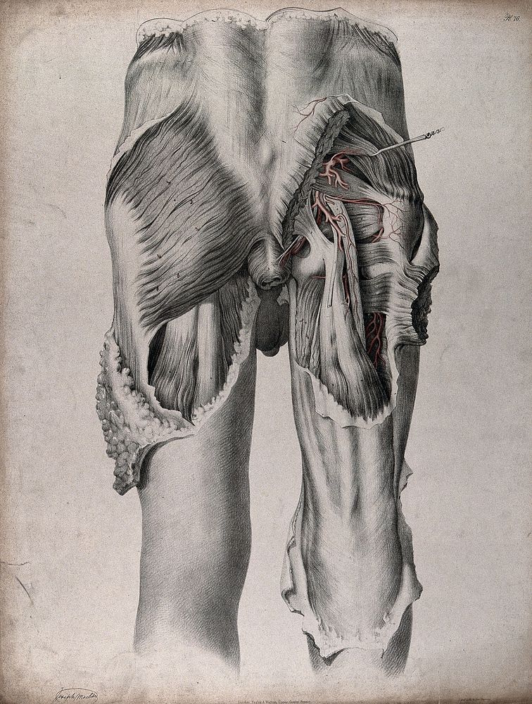 The circulatory system: dissection of the buttocks and upper thighs of a man, seen from behind, with blood vessels indicated…