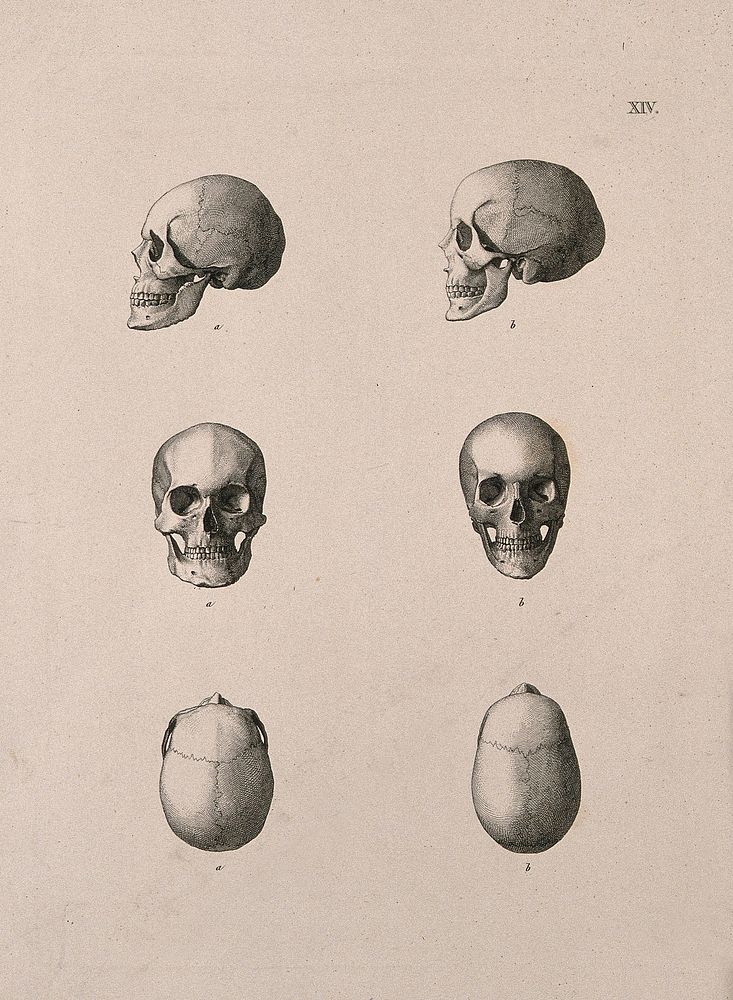 Human skulls: six figures. Etching, 18--.