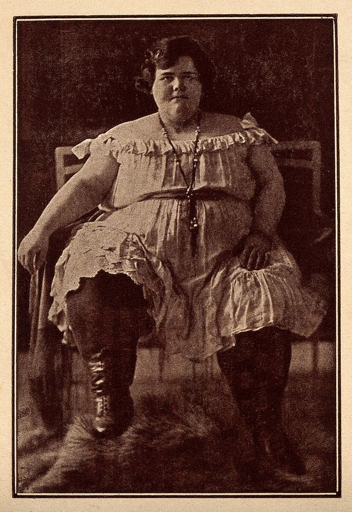 Teresina, a young woman weighing 265 kg. Halftone after a photograph.