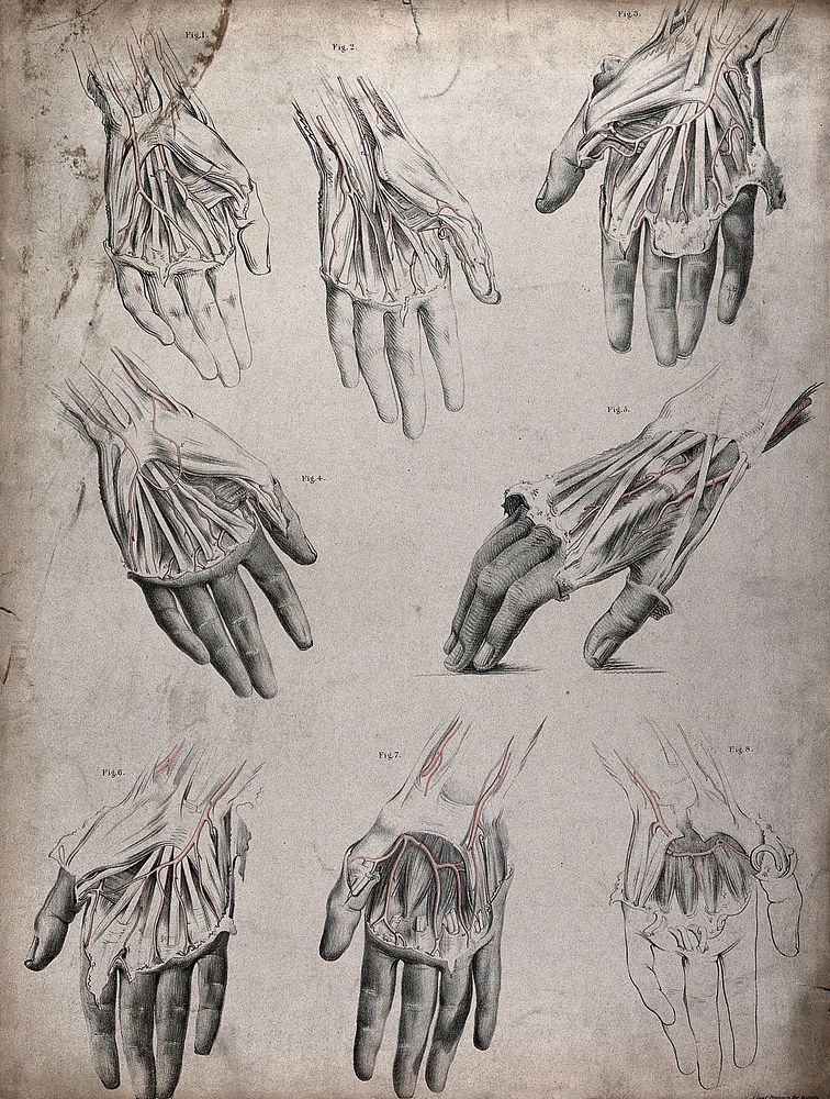 The circulatory system: dissections of the hand, with the arteries indicated in red. Coloured lithograph by J. Maclise…