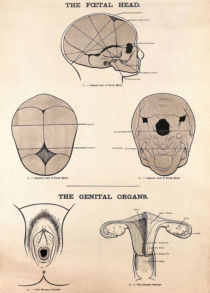The foetal head and female genital organs. Lithograph after W. F. Victor Bonney.