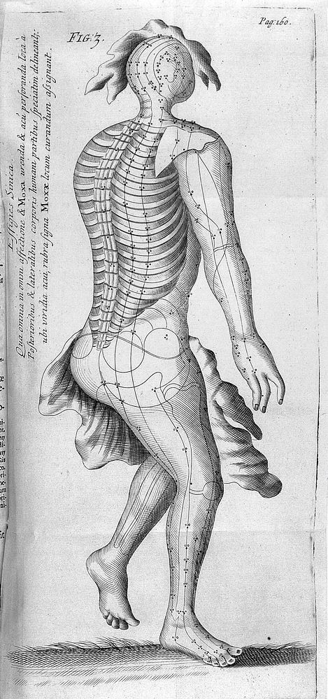 A treatise on acupuncturation; being a description of a surgical operation originally peculiar to the Japonese [sic] and…