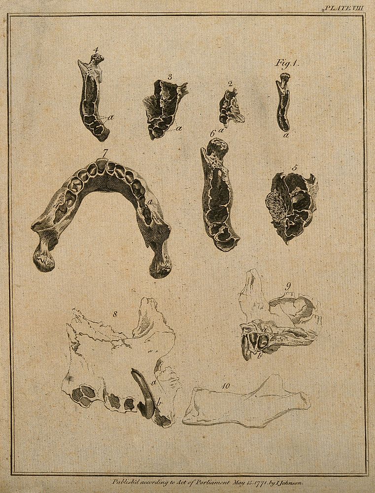 Skull and jaw bones, with teeth: ten figures. Line engraving, 1771.
