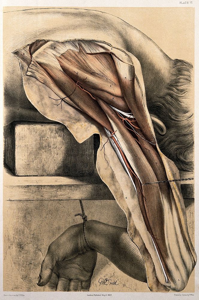 Dissection of the shoulder. Colour lithograph by G.H. Ford, 1863.