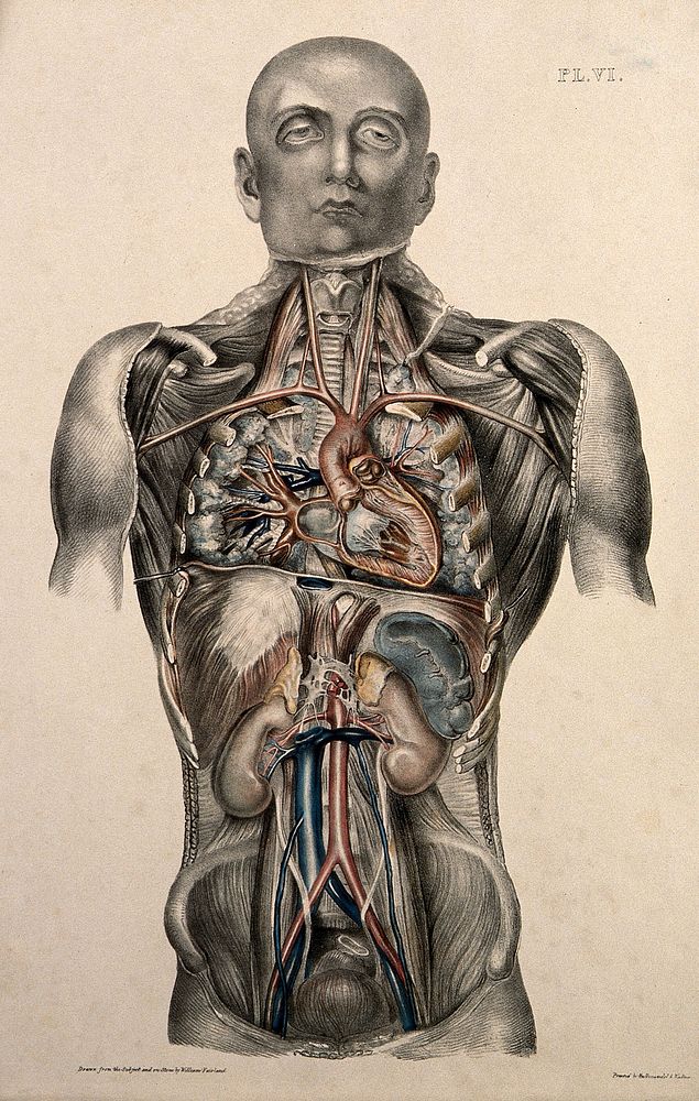 The body of a standing man with his head shaved and his trunk dissected to reveal the ribs and viscera. Coloured lithograph…