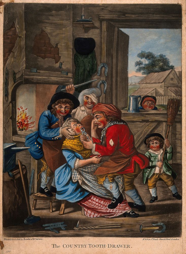 A country blacksmith in his forge extracting a tooth from a woman who is being restrained and taunted by her family.…