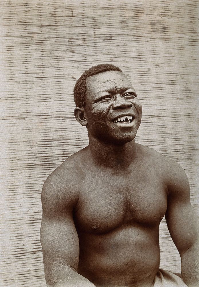 Nigeria: a man at Egbe with shaped front teeth. Photograph.