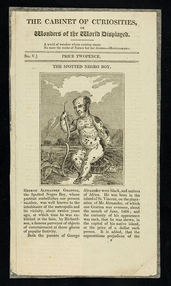 The cabinet of curiosities, or wonders of the world displayed. No.5, The Spotted Negro Boy.