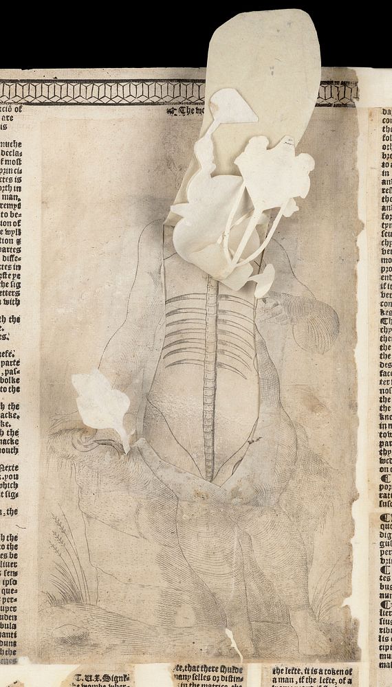 Anatomical fugitive sheets