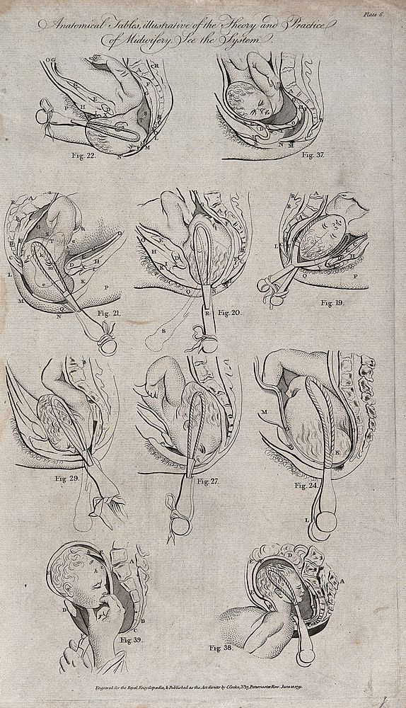 Ten diagrams illustrating various methods of delivering a baby using forceps. Etching, 1791.