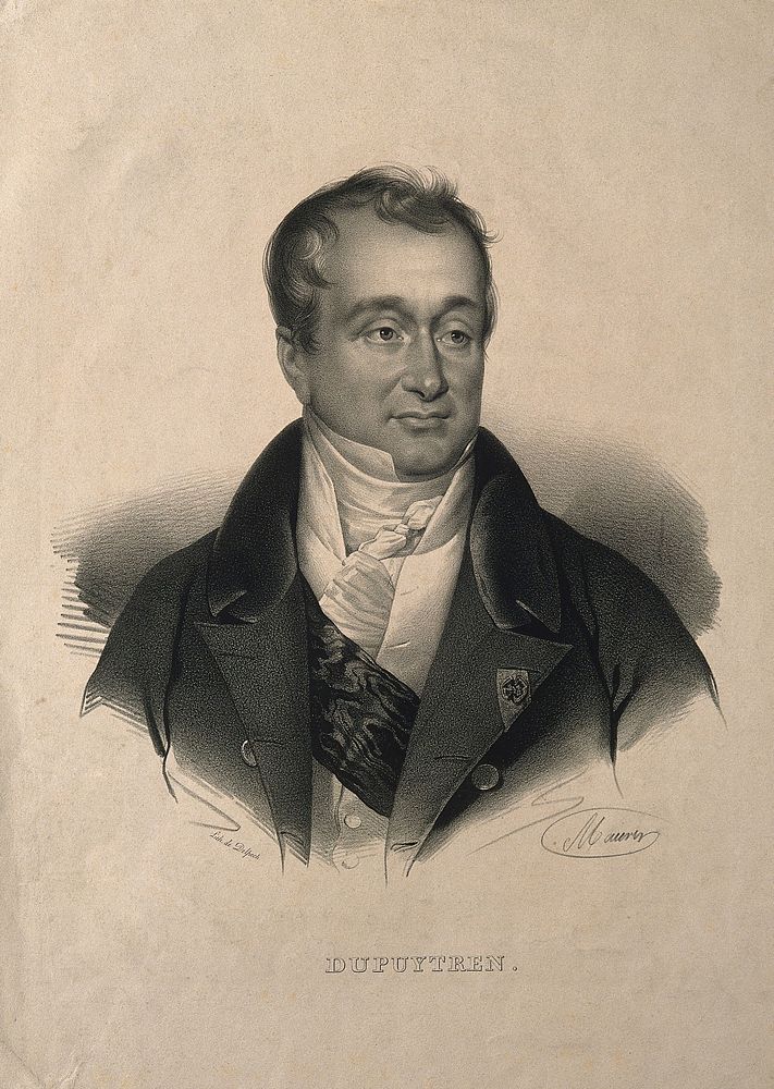 Guillaume, Baron Dupuytren. Lithograph by N. E. Maurin, 1837.