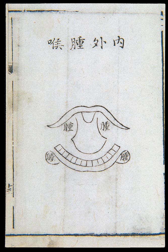 C18 Chinese woodcut: Inflammation of the throat