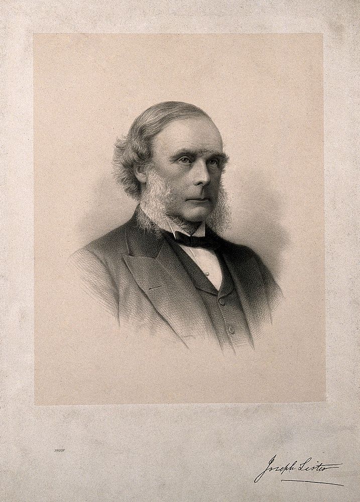 Joseph Lister, 1st Baron Lister. Lithograph.