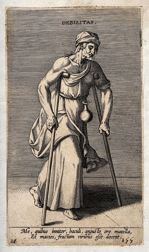 A feeble old woman with a flask attached to her hip moves with the aid of two crutches; illustrating debility. Engraving by…