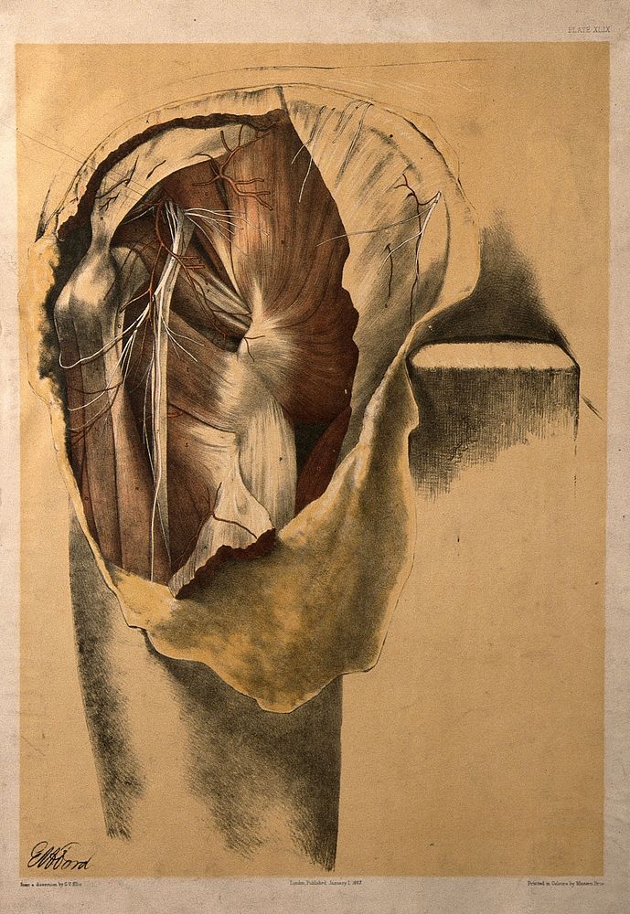Dissection of the hip, upper thigh and buttock of a man, showing the muscles, bones and blood vessels. Colour lithograph by…