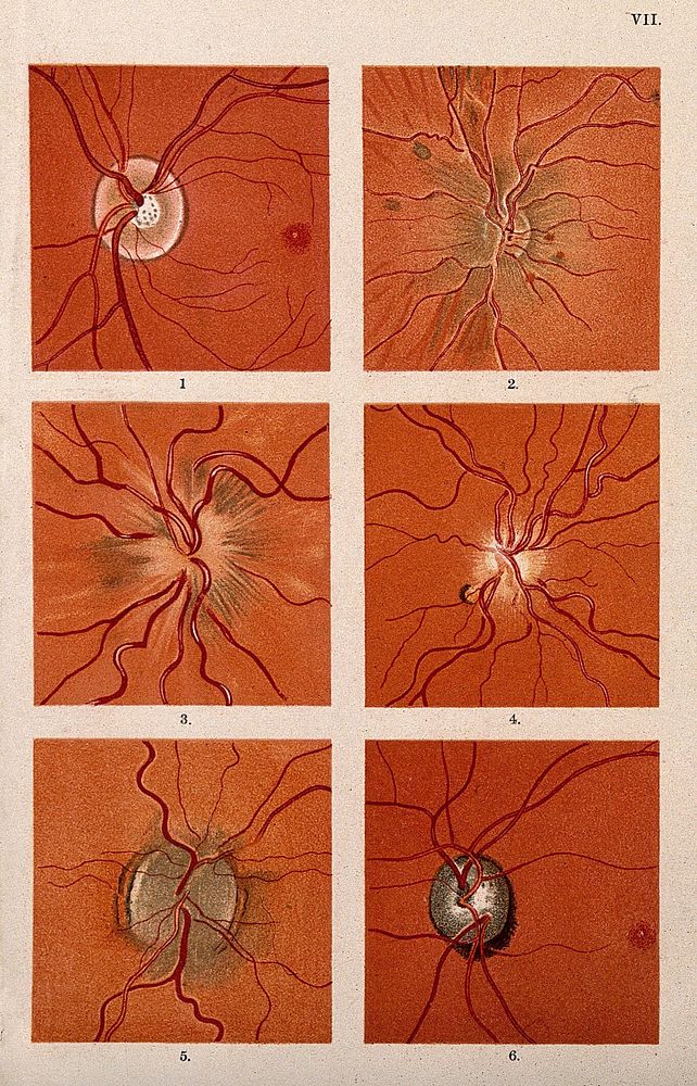 The eye, as seen through a microscope: three figures. Colour lithograph, ca. 1862.