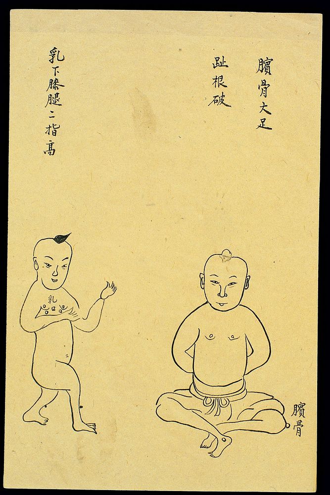 C19 Chinese ink drawing: Boils on kneecap and under breast