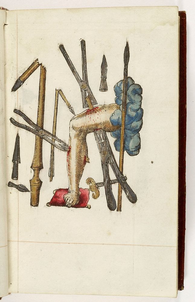 Instrumenta chyrurgiae et icones anathomicae / [Ambroise Paré].