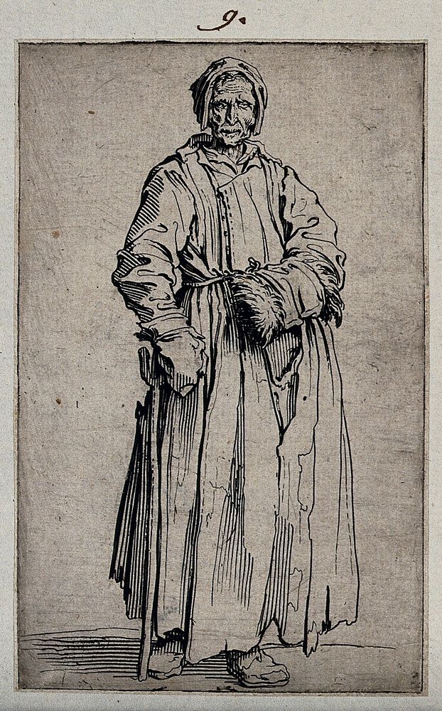 A one-eyed beggar woman. Etching with engraving by Jacques Callot, ca. 1622.