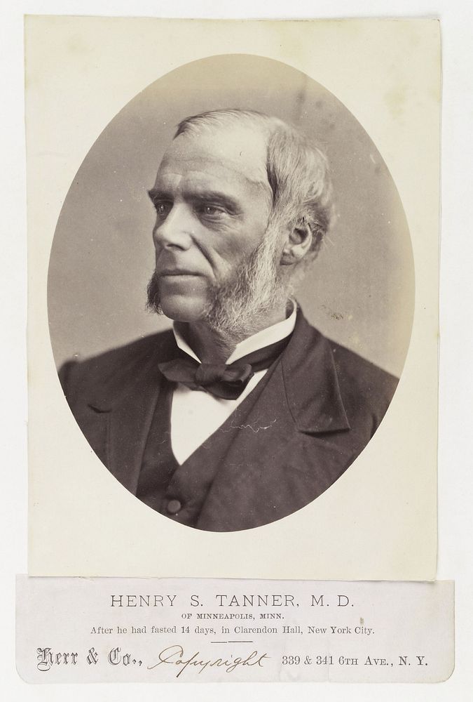 Henry S. Tanner after 14 days of his 40-day fast at Clarendon Hall, New York City. Photograph, 1880.