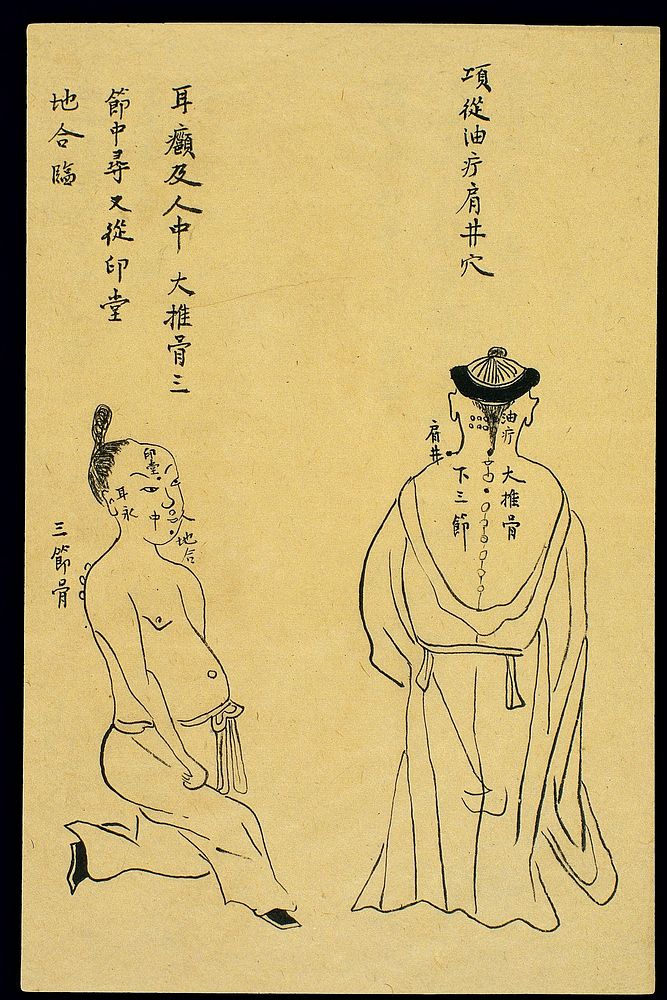C19 Chinese ink drawing: Boils - oily boil, ear abscess, etc.