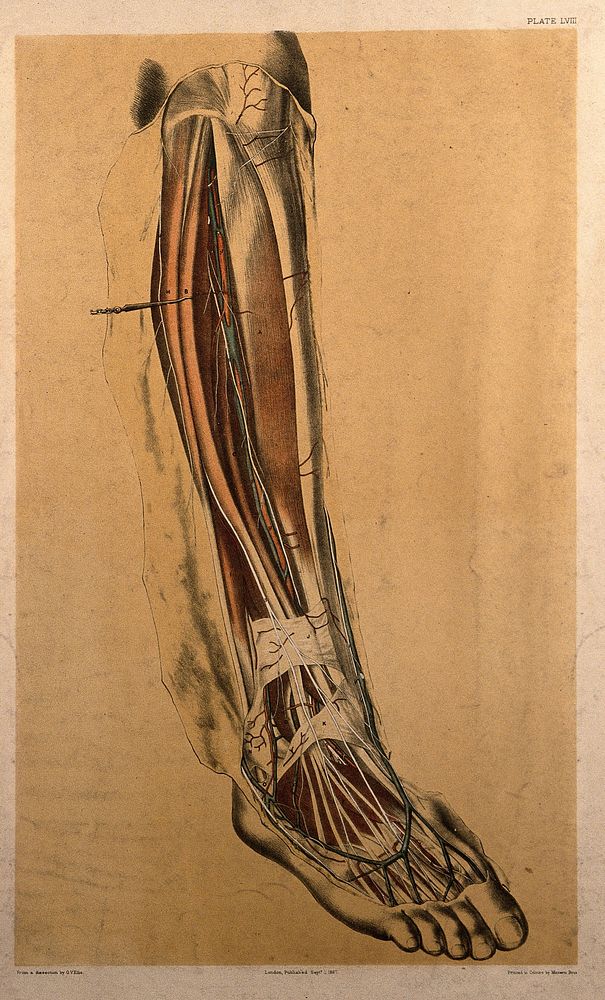 Dissection of the back of the lower leg, showing the muscles, blood vessels and veins of the calf and ankle. Colour…