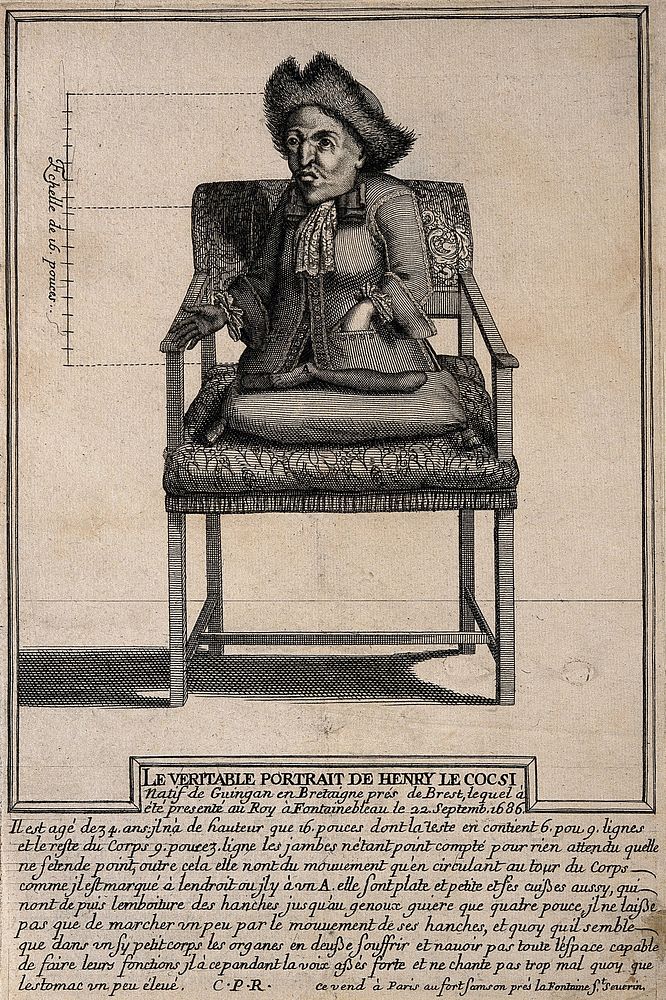 Henry Le Cocsi, a dwarf with paralysed legs, aged 34. Engraving.