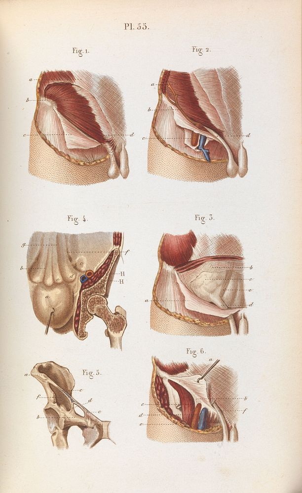 Plate 55, Surgical anatomy of the inguinal region of the abdominal wall.