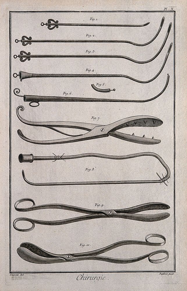 Surgery: surgical instruments including a catheter and lithotomy forceps. Engraving with etching by A.J. Defehrt after L.-J.…