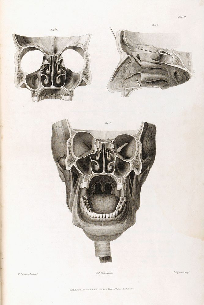 Anatomico-chirurgical views of the nose, mouth, larynx, & fauces / with appropriate explanations, and references ... The…