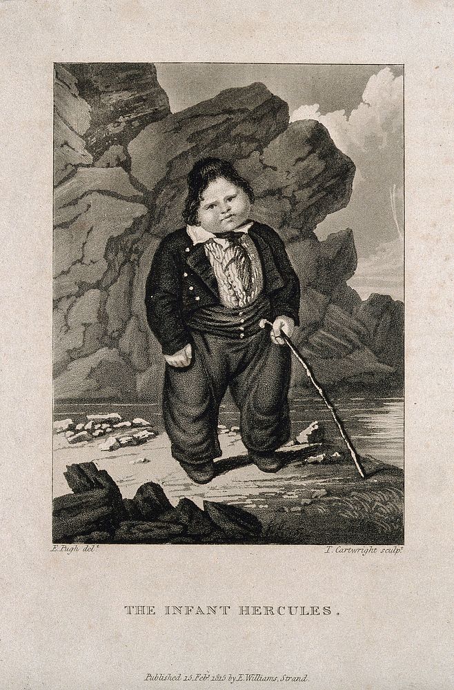 Hercules, a very large child. Aquatint by T. Cartwright, 1815, after E. Pugh.