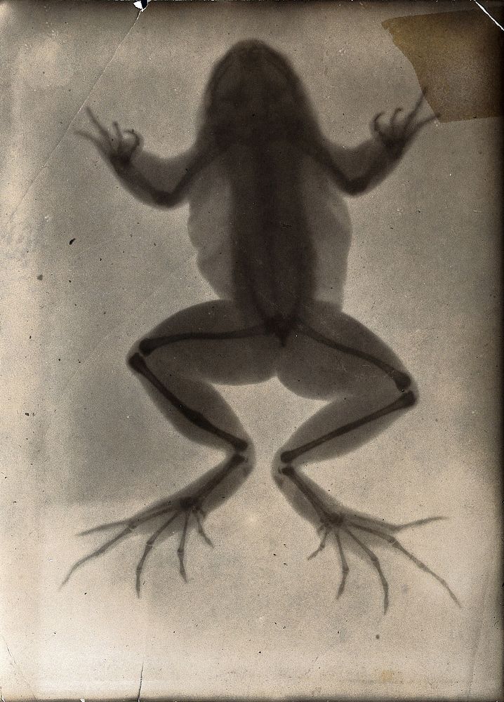 The bones of a frog, viewed through x-ray; revealing a healing fracture on one of the hind legs. Photoprint from radiograph…