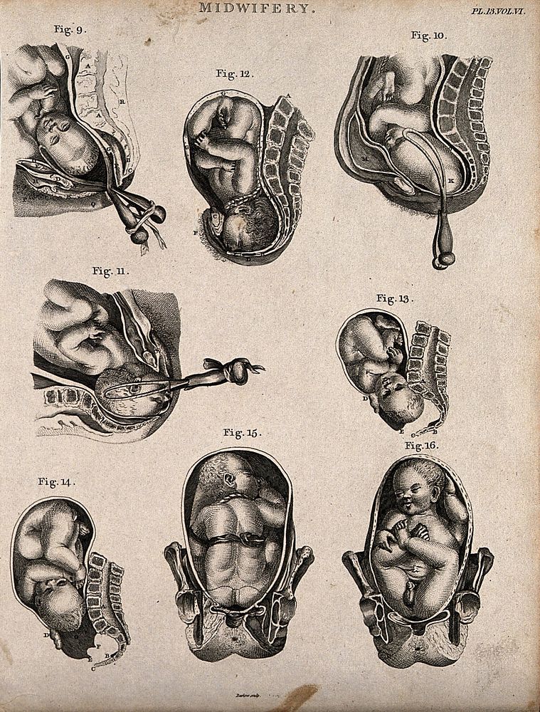 Eight diagrams illustrating babies in the womb in different positions about to enter the world. Etching by Barlow.