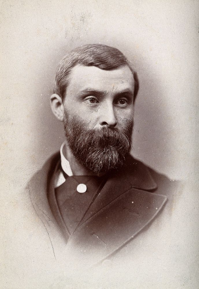 Sir Thomas Lauder Brunton. Photograph by G. Jerrard, 1881.