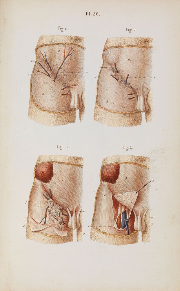 Plate 56, Surgical anatomy of the inguinal area.