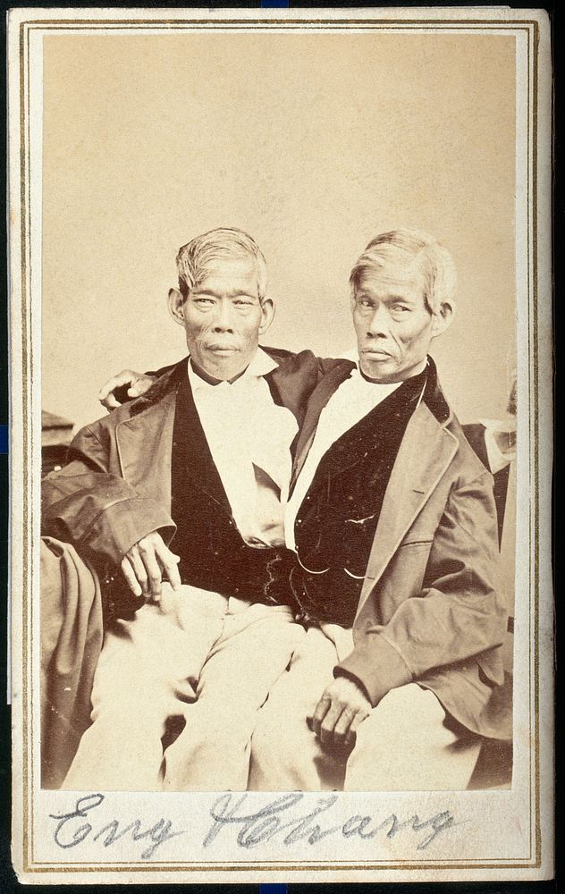 Chang and Eng, conjoined twins, seated. Photograph, c. 1860.