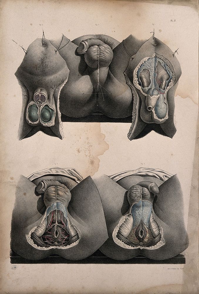 Dissection of the anus, perinaeum and scrotum of a man. Coloured lithograph by J. Maclise, 1851.