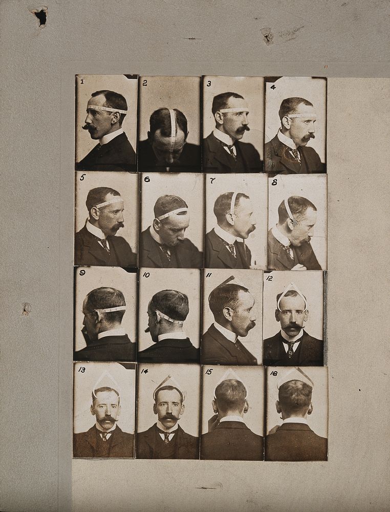 The phrenologist Bernard Hollander illustrating with his own head his system of cranial measurements. Photographs, c. 1902.