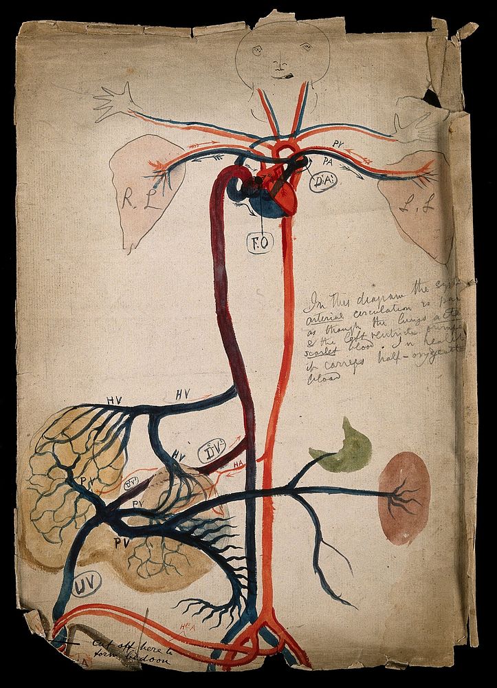 The circulatory system: diagram showing the heart, arteries, lungs and major organs, with a cartoon-style face and hands.…