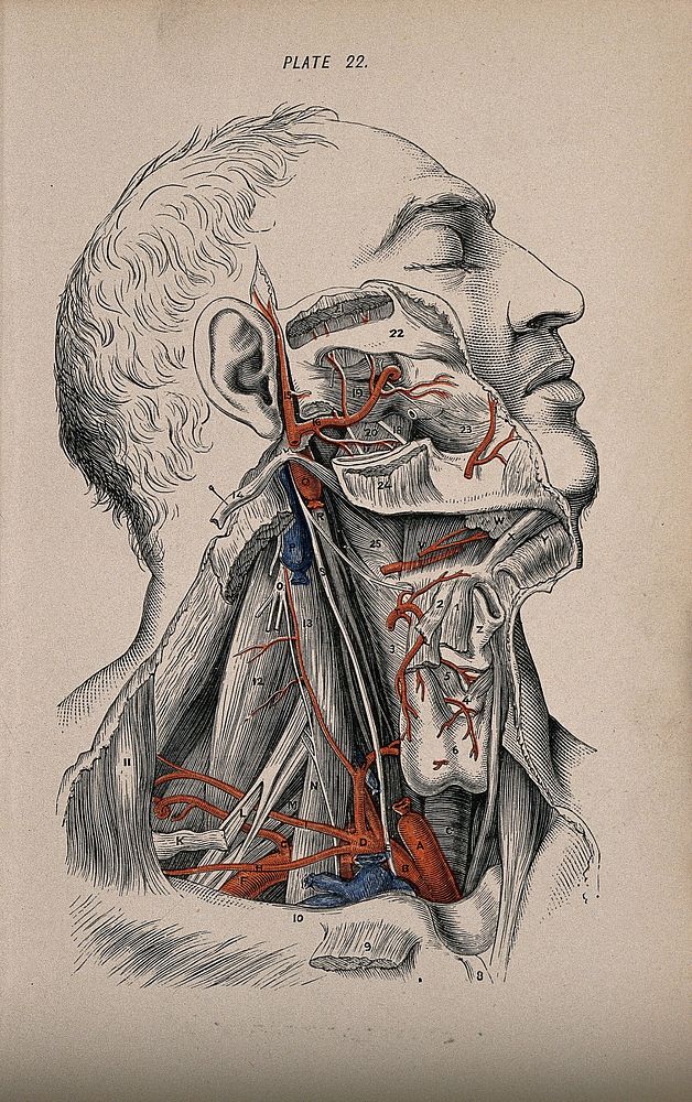 Dissection of the neck and cheek. Colour wood engraving with letterpress, 1860/1900.