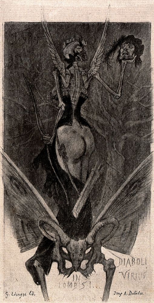 A winged woman with a skull as her head, standing in a man's pelvis, holding in one hand a bow and in the other a man's…