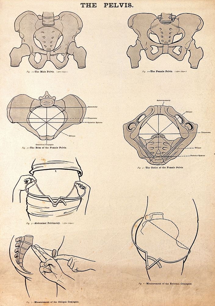 The pelvis in pregnancy. Lithograph after W. F. Victor Bonney.