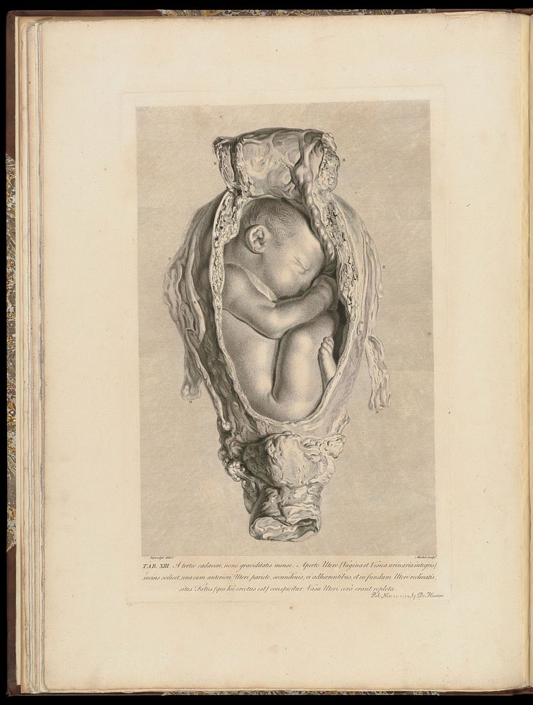 Anatomia uteri humani gravidi tabulis illustrata ... The anatomy of the human gravid uteris exhibited in figures / [William…