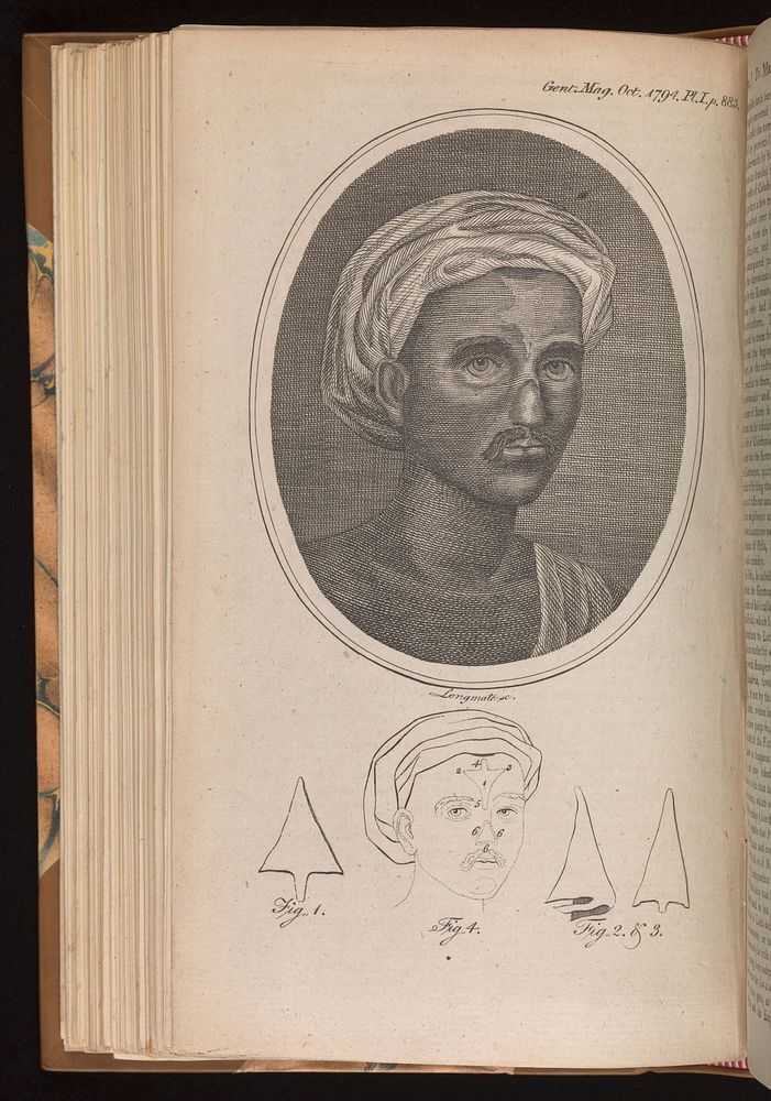 Indian method of surgical restoration of the nose. 1764.