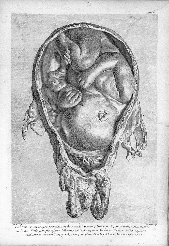 Anatomia uteri humani gravidi : tabulis illustrata = the anatomy of the human gravid uterus exhibited in figures / auctore…