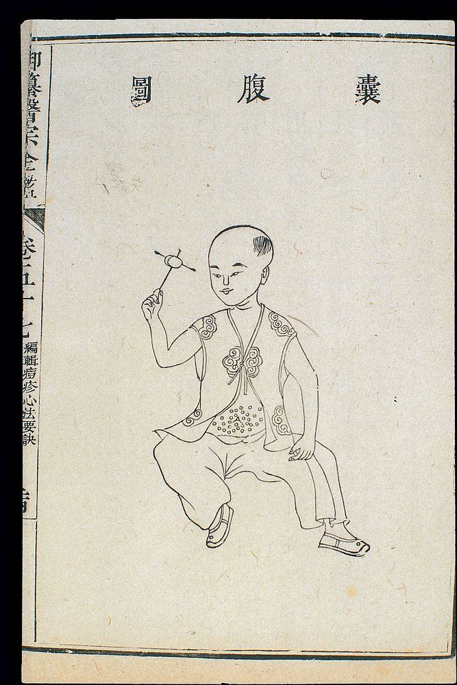 Chinese C18: Paediatric pox - 'Belly Vescicles' pox