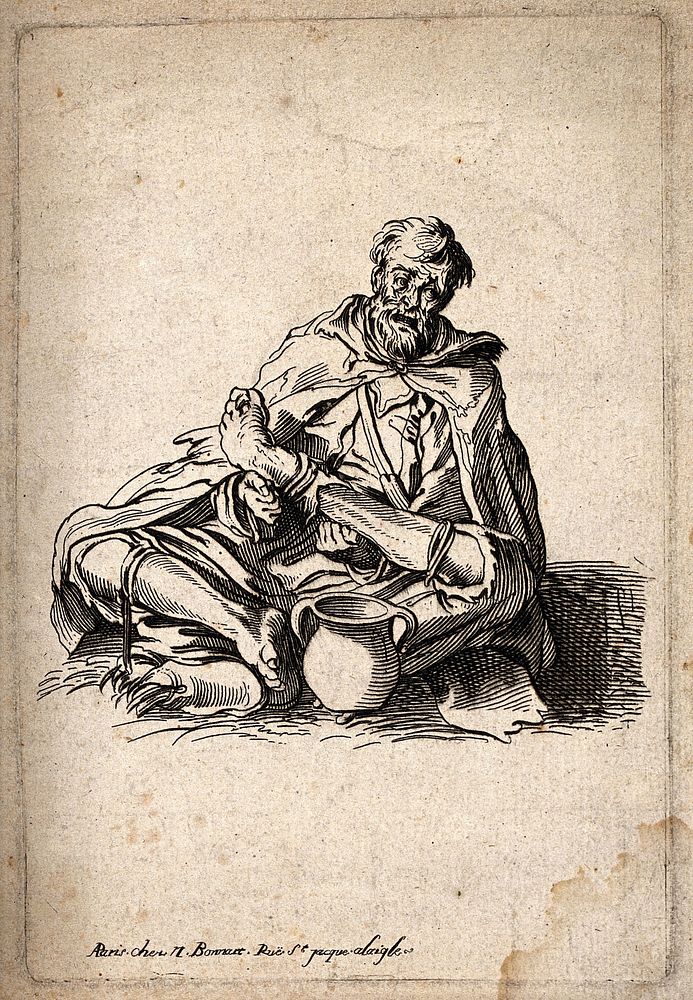 A beggar crouching on the ground next to a jug holding his deformed left leg in his hands. Engraving.